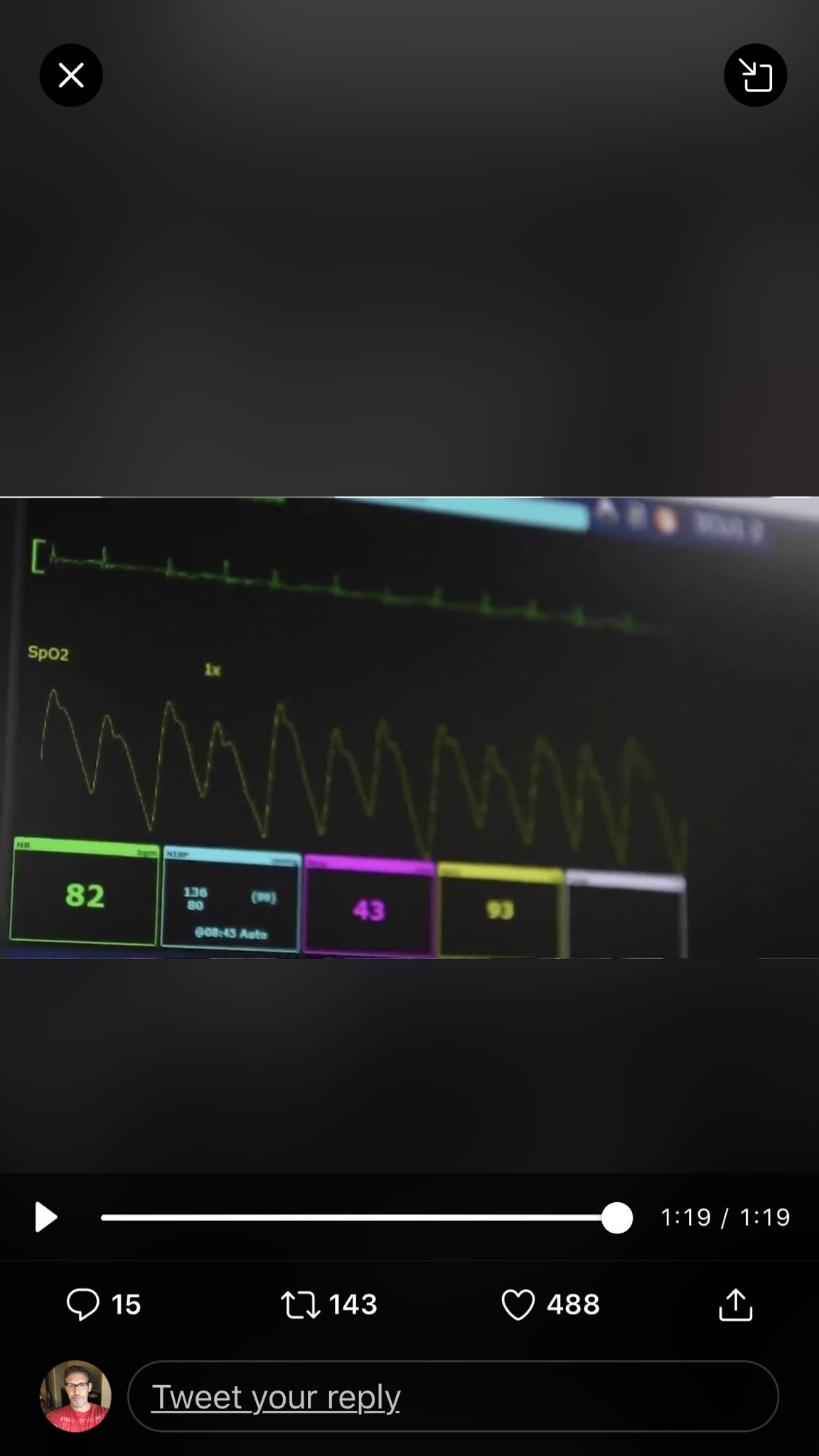 ❤️childprotectorMD,MSc on Twitter: "CONFIRMED. There are children on the US Comfort. I’m a pediatric pulmonologist. This is a monitor for an intubated child. I know this bc it’s stable, set at respiration of 40. Thats an infant/toddler. Bet my life on it.… https://t.co/WLPWVEBo53"