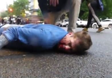 Portland Man Chased, Knocked Out, Kicked in the Head while Unconscious after Trying to Flee Riots - Tooth Knocked Out (VIDEO)