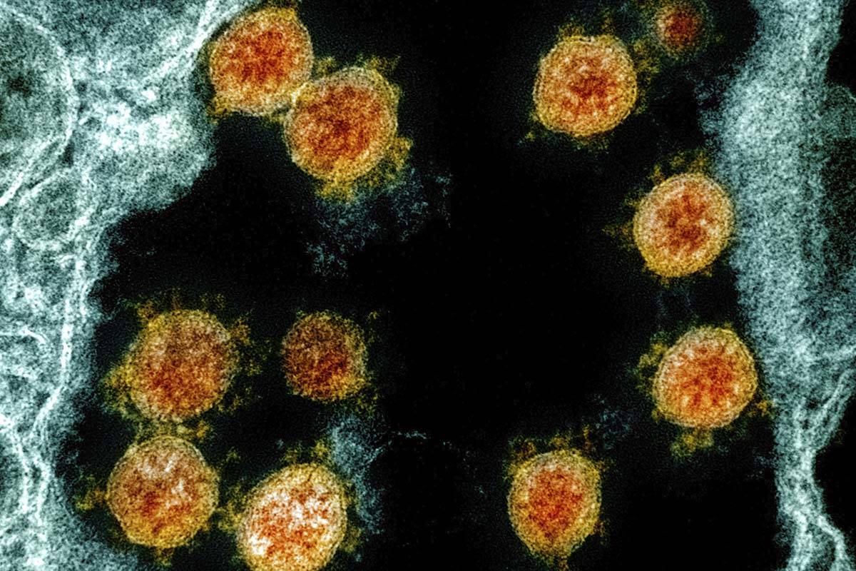 Sweden now a coronavirus success story | Las Vegas Review-Journal