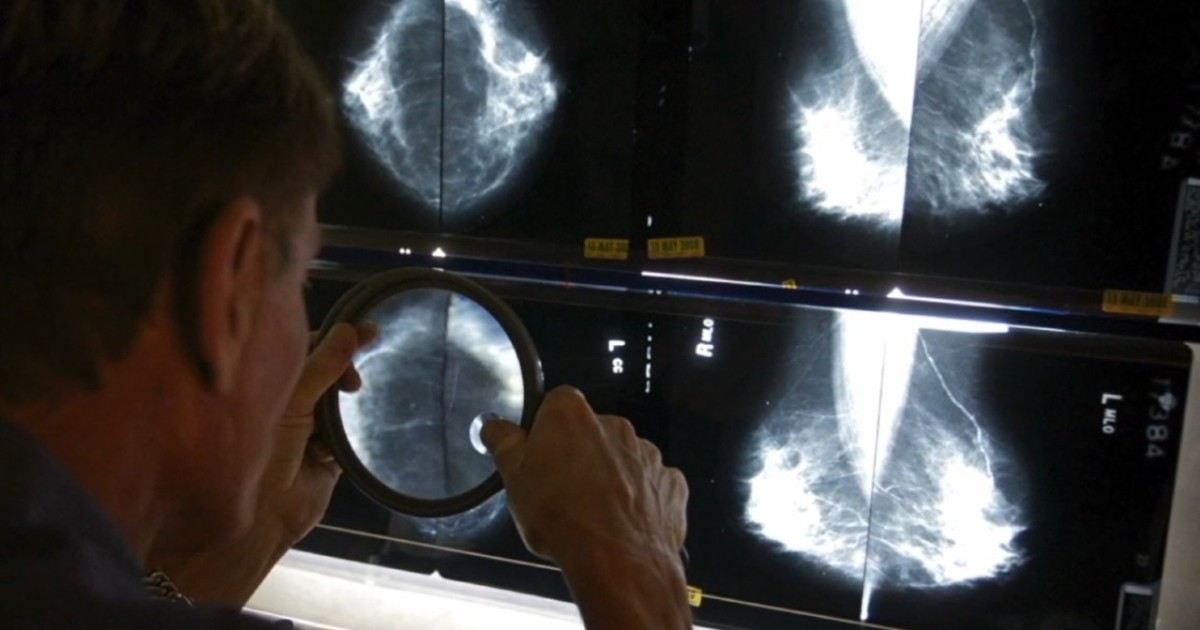 New mammogram guidelines for women recently vaccinated for COVID-19