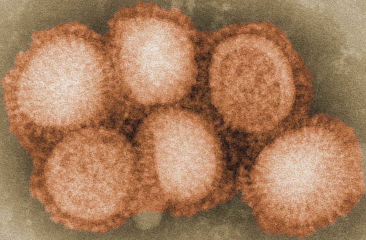 1957–1958 influenza pandemic - Wikipedia