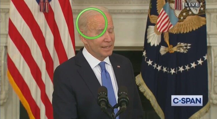 Observers Notice Bizarre Spot on the Side of Biden's Head as He Goes Blank For 8 Seconds Straight During Presser (VIDEO)