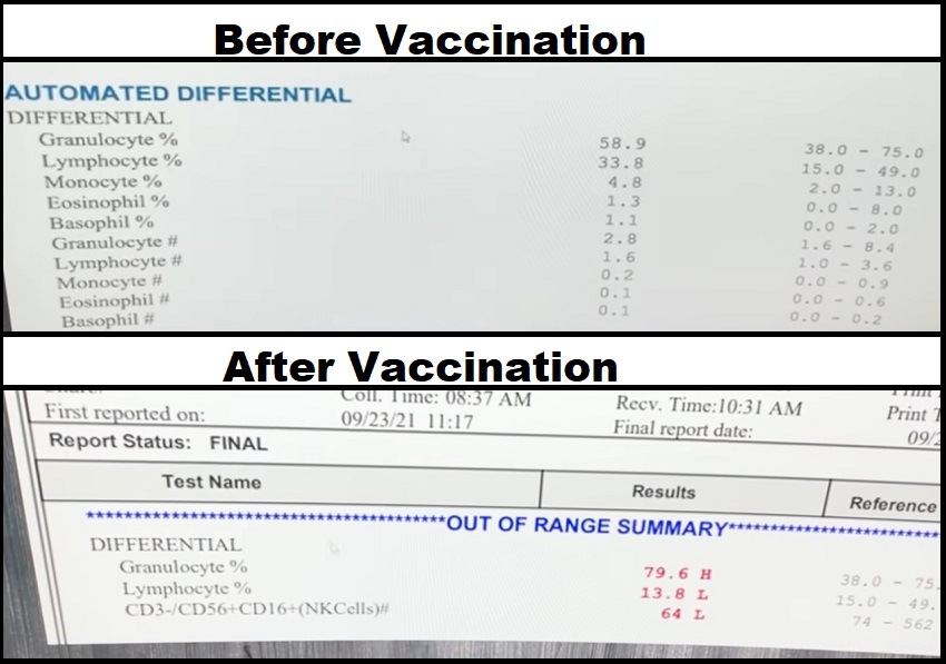 Doctor Performs Blood and Immune System Test Before and After COVID Vaccination, The Alarming Results Motivate Him to Share This Video - The Last Refuge