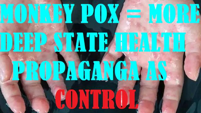 MONKEY POX = MORE DEEP STATE HEALTH PROPAGANDA AS CONTROL
