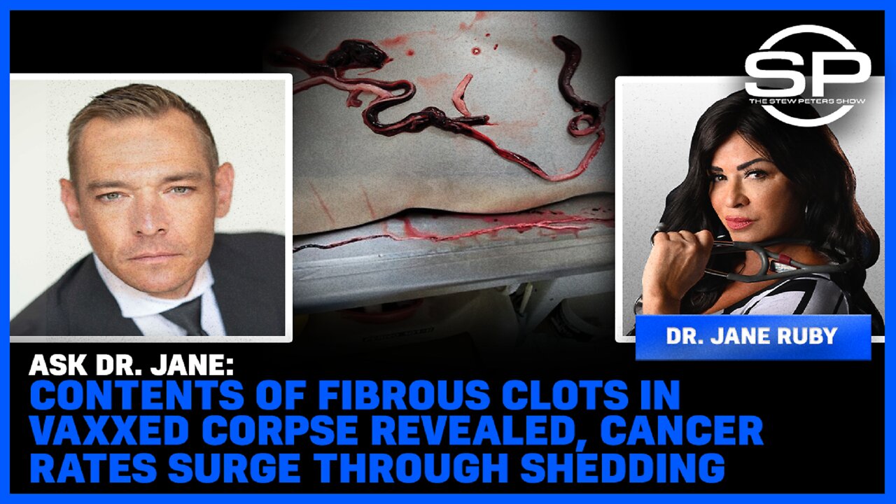 Contents Of Fibrous Clots In Vaxxed Corpse Reveled, Cancer Rates Surge Through Shedding – Stew Peters