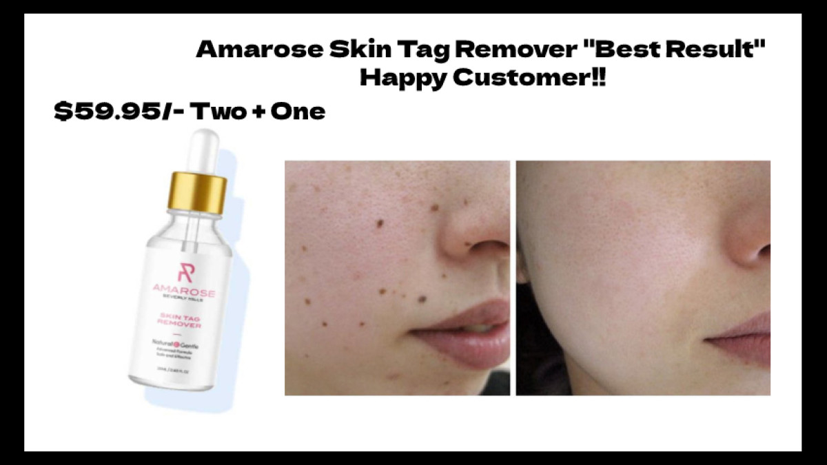 https://www.outlookindia.com/outlook-spotlight/-report-2022-amarose-skin-tag-remover-reviews-shocking-facts-does-amarose-worth-69-95-cost-in-usa--news-220859