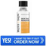 Bliss Skin Tag Remover Profile Picture