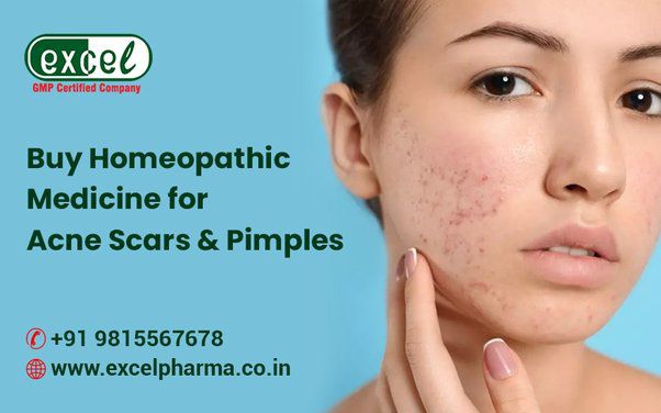 Homeopathic Medicines for Pimples & Acne Scars - Gentle Healing - Buy Homeopathic Medicine Online