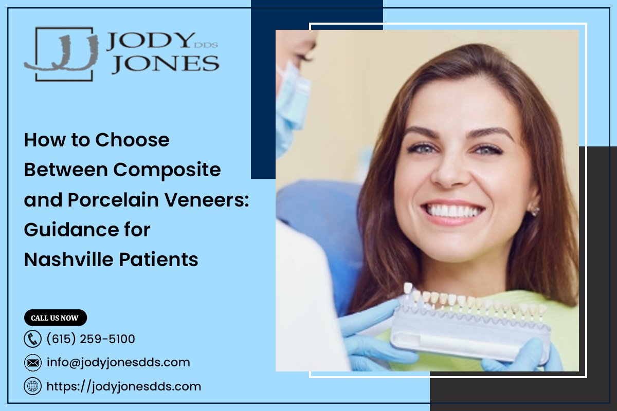 How to Choose Between Composite and Porcelain Veneers: Guidance for Nashville Patients – JODY JONES DDS